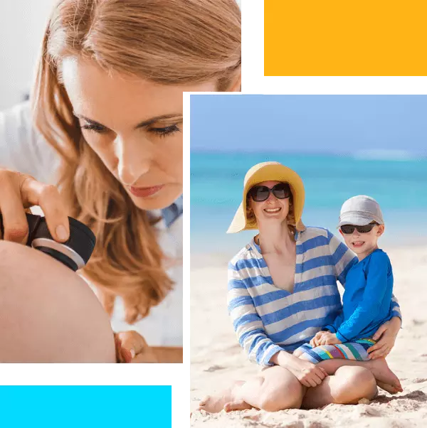 skin-cancer-prevention