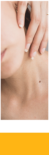 skin-cancer-video-border-left-01